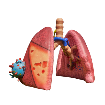 mega lungs